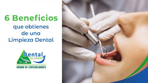 6 Beneficios Que Obtienes De Una Limpieza Dental Clinica Dental Del